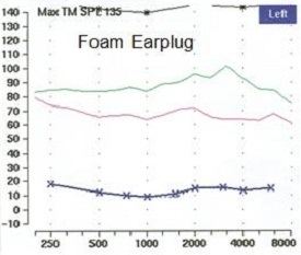 Name:  foam earplug frequency response.jpg
Views: 398
Size:  20.7 KB